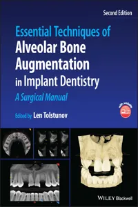 Essential Techniques of Alveolar Bone Augmentation in Implant Dentistry_cover