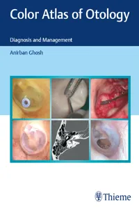 Color Atlas of Otology_cover