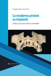 La moderna protesi su impianti_cover