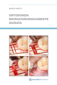 Ortodonzia microchirurgicamente guidata_cover