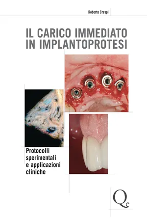 IL CARICO IMMEDIATO IN IMPLANTOPROTESI