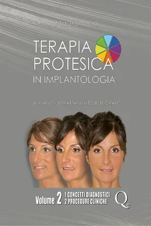 Terapia protesica in implantologia. Volume 2