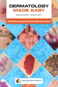 Dermatology Made Easy_cover