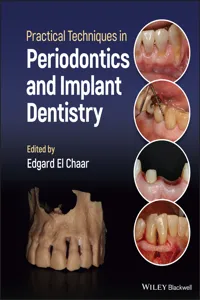 Practical Techniques in Periodontics and Implant Dentistry_cover