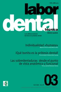 Labor Dental Técnica Nº3 Vol.25_cover