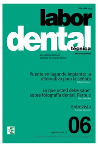 Labor Dental Técnica Nº6 Vol.25_cover