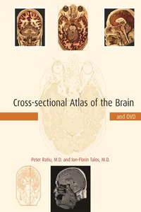Cross-sectional Atlas of the Brain and DVD_cover