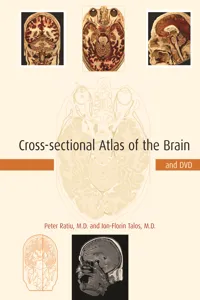 Cross-sectional Atlas of the Brain and DVD_cover