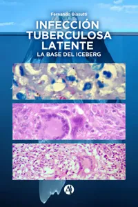 Infección Tuberculosa Latente, la base del iceberg_cover