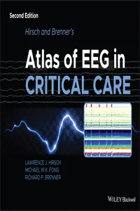 Hirsch and Brenner's Atlas of EEG in Critical Care_cover