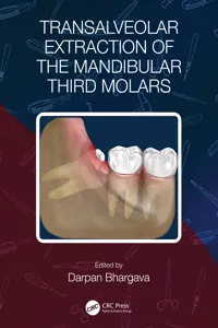 Transalveolar Extraction of the Mandibular Third Molars_cover