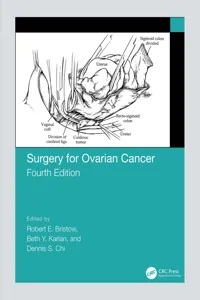 Surgery for Ovarian Cancer_cover