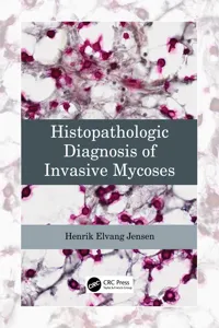 Histopathologic Diagnosis of Invasive Mycoses_cover