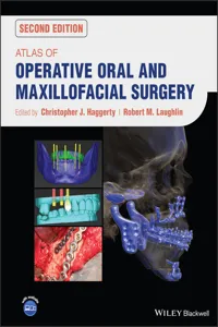 Atlas of Operative Oral and Maxillofacial Surgery_cover