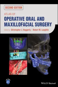 Atlas of Operative Oral and Maxillofacial Surgery_cover