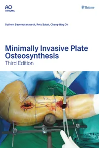 Minimally Invasive Plate Osteosynthesis_cover