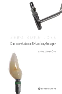 Zero Bone Loss: Knochenerhaltende Behandlungskonzepte_cover