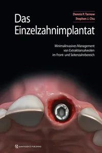 Das Einzelzahnimplantat_cover