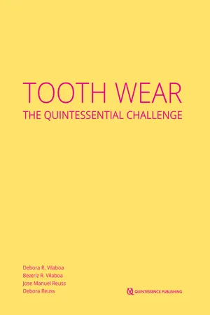 Tooth Wear