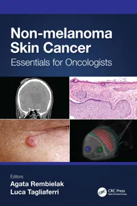 Non-melanoma Skin Cancer_cover