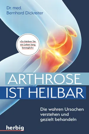 Arthrose ist heilbar