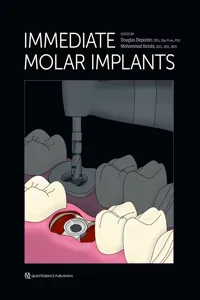 Immediate Molar Implants_cover