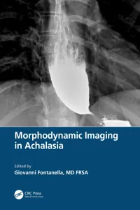 Morphodynamic Imaging in Achalasia_cover