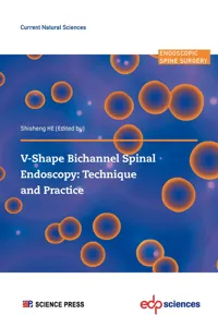 V-Shape Bichannel Spinal Endoscopy: Technique and Practice_cover