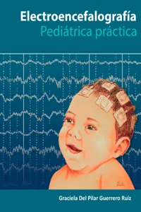 Electroencefalografía Pediatría Práctica_cover