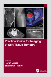 Practical Guide for Imaging of Soft Tissue Tumours_cover
