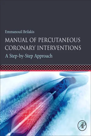 Manual of Percutaneous Coronary Interventions