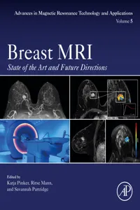 Breast MRI_cover