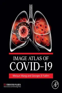 Image Atlas of COVID-19_cover