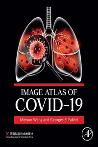 Image Atlas of COVID-19_cover