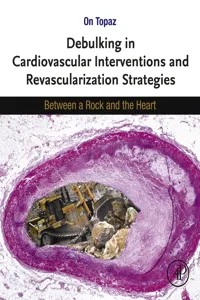 Debulking in Cardiovascular Interventions and Revascularization Strategies_cover