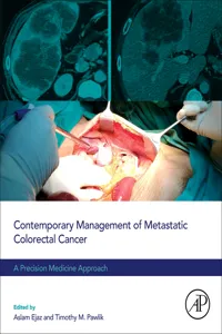 Contemporary Management of Metastatic Colorectal Cancer_cover