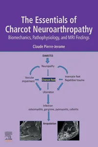 The Essentials of Charcot Neuroarthropathy_cover