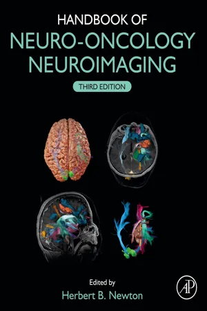 Handbook of Neuro-Oncology Neuroimaging