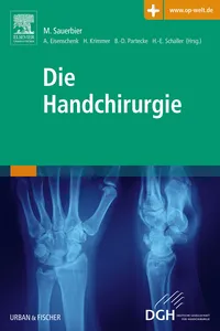 Sauerbier, Die Handchirurgie Teil 3_cover