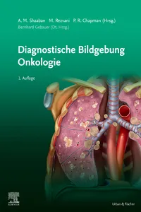 Diagnostische Bildgebung Onkologie_cover