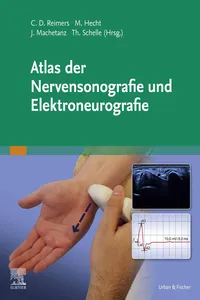 Atlas der Nervensonografie und Elektroneurografie_cover