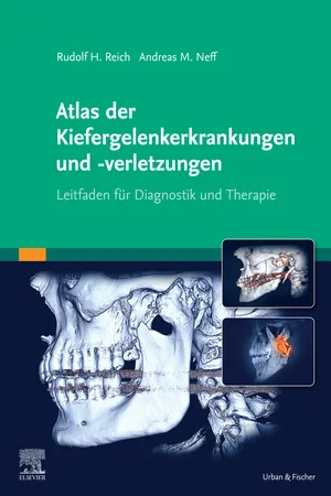 Atlas der Kiefergelenkerkrankungen und -verletzungen