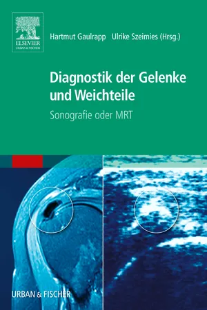 Diagnostik der Gelenke und Weichteile