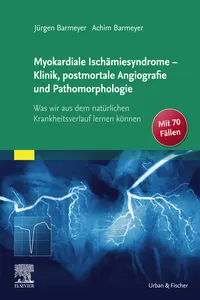 Die myokardialen Ischämiesyndrome - Klinik und postmortale Pathomorphologie_cover