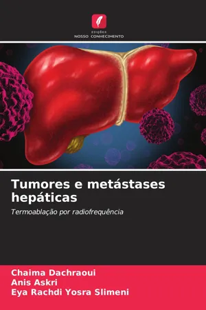 Tumores e metástases hepáticas