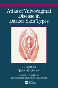 Atlas of Vulvovaginal Disease in Darker Skin Types_cover