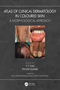 Atlas of Clinical Dermatology in Coloured Skin_cover