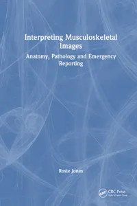 Interpreting Musculoskeletal Images_cover