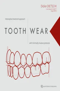 Tooth Wear_cover