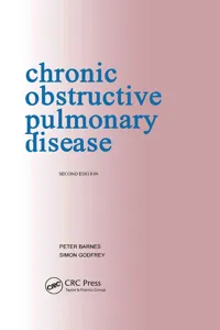 Chronic Obstructive Pulmonary Disease: pocketbook_cover